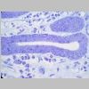Intestino Delgado 20.jpg